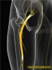 Back pain treatment In Delhi,Best Back Pain Doctor in Delhi 