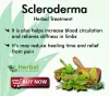 Natural Remedies for Scleroderma and treat Symptoms with Herbal Supplements