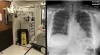 Imaging Equipment Playing Key Role In Battling Covid-19 - Parker Lighting