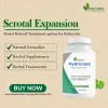 Scrotal Expansion