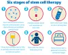 Stem Cell Treatment In India