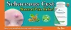 Infected Cyst Wound Care