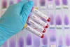 free std and hiv testing clinics