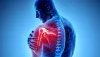 What causes shoulder pain and how to treat it?