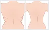 Body Cosmetic Surgery Procedures In Dubai | Hasan Surgery