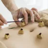 Moxabustion "moxa" - Massage, Acupuncture, &amp; Nutrition - Bermuda
