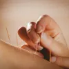Acupuncture in Bishop's Stortford - Donna Millard BSc (Hons)