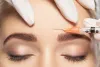 Learn About Fast And Easy Way To Remove Acne Scars? | What are the Things You Should Know About Botox Treatment?