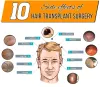 10 Side effects of Hair Transplant Surgery - AK Clinics