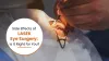 Side Effects of LASEK Eye Surgery: Is it Right for You| Dr. Jeevan Ladi