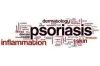 Common Signs and Symptoms of Psoriasis