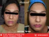 #No1 Skin Tightening Treatment in Durgapur