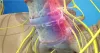 Best Slipped Bone Surgeon in Gurgaon