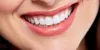 Dr. Sanjay Kalra | Best Dentist in Panchkula | Braces in Panchkula