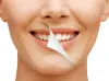 The Art of Digital Smile Designing