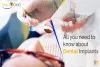 Dental Implants Treatment in Gurgaon