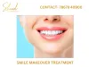 Smile design in coimbatore India shaadaesthetics 
