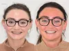 Dental Veneers Manchester - City Centre Private Dental Practice