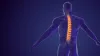 Spine Fusion Surgery