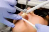 Home - Jeffrey Linda - How You Can Cure Swollen Gums at Home?