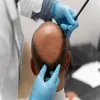 Stem Cell Therapy &amp; Treatment in Dubai, Abu Dhabi &amp; Sharjah | Cost