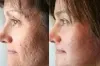 Stem Cell Therapy &amp; Treatment in Dubai, Abu Dhabi &amp; Sharjah | Cost