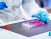 Best Stem Cell Treatment in India | Stem Cell Cure (P) Ltd.