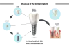 Dental Implants: Everything You Need to Know