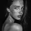 Sun Damage &amp; Skin Pigmentation Treatment Toronto | Tight Clinic