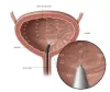 Symptoms and Treatment for Urinary Problems Cape Town