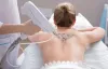 laser hair removal warner robins