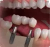 Home - Jeffrey Linda - Enjin - Stay Relaxed By Choosing Dentist For Impacted Wisdom Teeth