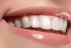 Best Dental Clinic in Gurgaon | Top Dentist in Gurugram - Ministry of Smile
