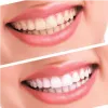 Teeth Whitening Singapore | Meet your Dentist today
