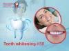  How can teeth whitening benefit you?           |          smiles-N-aesthetics 