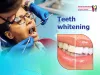 Reasons to Go for Regular Teeth Whitening