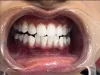 Best Dentist in Mumbai