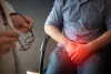 Swelling Reduction Techniques