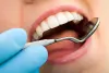 What is Invisalign and how does it work? – Article Room – Bloggers Unite