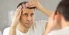 The Different Methods of Hair Transplant in Delhi