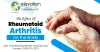 The Effect Of Rheumatoid Arthritis On The Wrists - arthritis