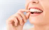 8 things to know before you have cosmetic dentistry - Blog
