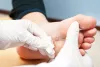 Diabetic Foot Treatment: Causes Symptoms &amp; Treatment - Dr Anuj Chawla