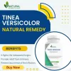 Treat Tinea Versicolor Naturally