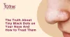The Truth About Tiny Black Dots on Your Nose and How to Treat Them - Skin Solutionz