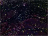 Tissue Immunolabeling and Imaging Analysis - CD BioSciences