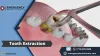 Tooth Extraction Near Me — ImgBB
