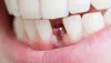 bestdentist [licensed for non-commercial use only] / Why Gum Specialist Dentists are Needed