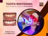 Tooth Whitening at FMS International Dental Center
