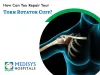 Shoulder Replacement | Rotator Cuff Surgery | Medisys Hospitals